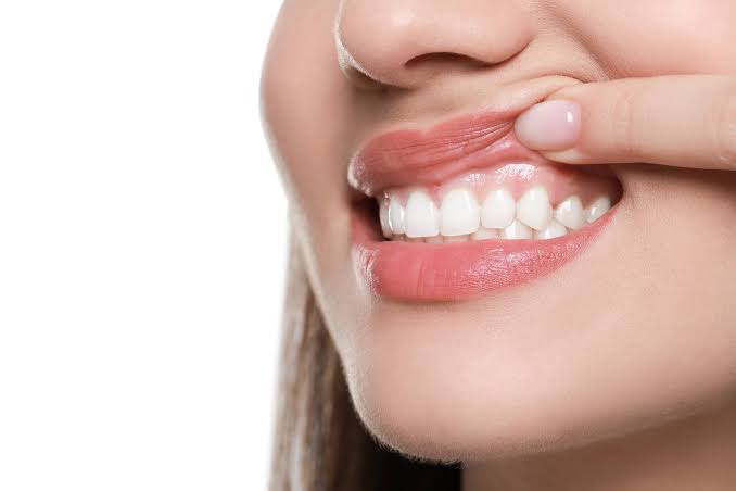 5 Common Myths About Gum Disease Debunked images 39